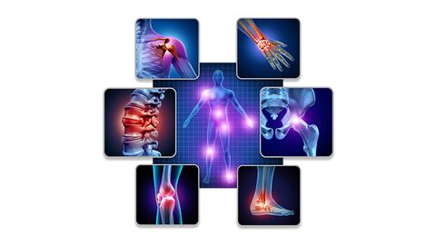 DU Douleur et Motricité Humaine - image image SPORT SCIENCE SANTÉ