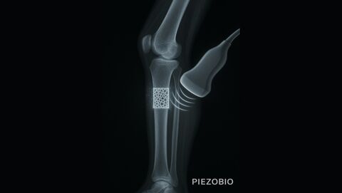 PIEZOBIO - matériaux piézoélectriques imprimables en 3D/4D pour le secteur biomédical PIEZOBIO - matériaux piézoélectriques imprimables en 3D/4D pour le secteur biomédical